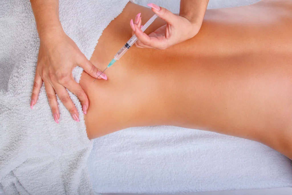 mesoterapia en marbella