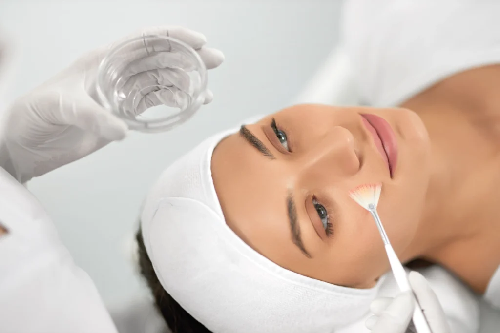 peeling quimico facial en marbella
