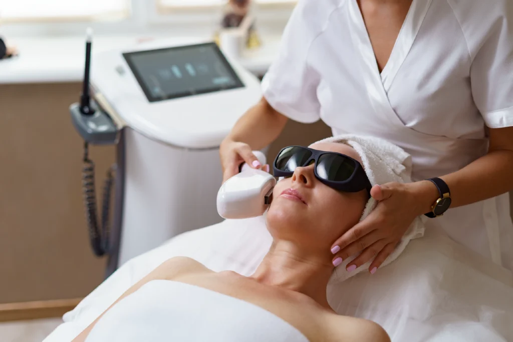 fotorejuvenecimiento facial en marbella