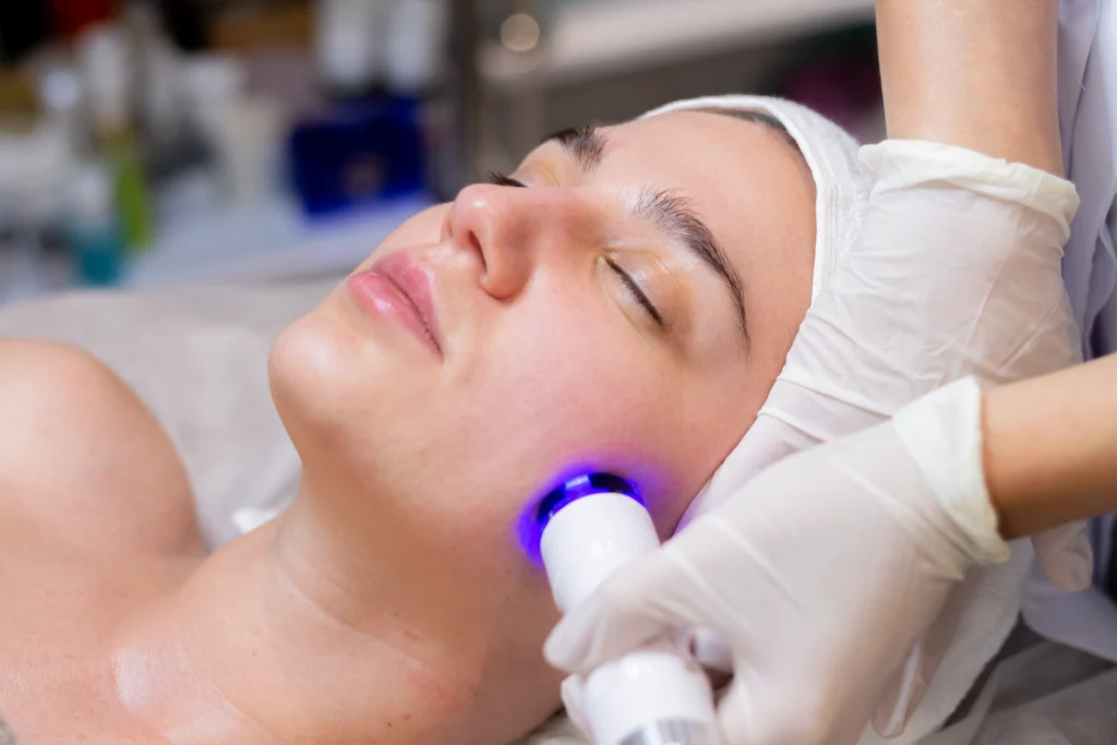 fotorejuvenecimiento en marbella